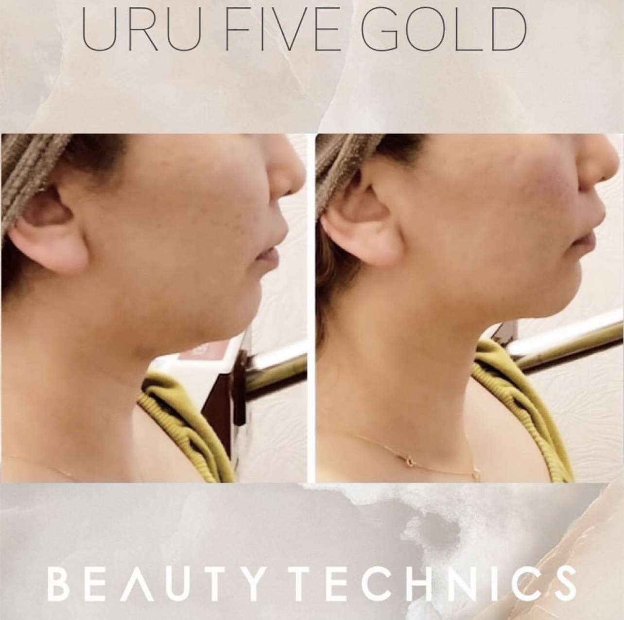 1秒先は老い!打ち勝っていきましょう